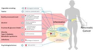 What can we help you find? A Review Of Lifestyle And Environment Risk Factors For Pancreatic Cancer European Journal Of Cancer