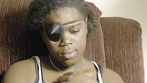 Losing sight, not vision: BB blinds teen's eye; she doesn't lose hope