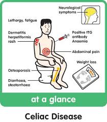 Welcome To The Paleo Network Celiac Disease Celiac Disease Test Celiac Disease Symptoms