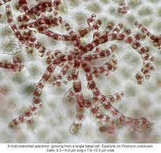 Image result for Acritochaete