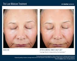 skinbetter science®