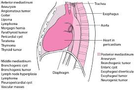 Mediastinal Masses Pulmonary Disorders Merck Manuals Professional Edition
