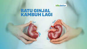 Kenali punca batu karang dan tanda tanda awal batu karang yang boleh kita perhatikan. Batu Ginjal Bisa Kambuh Ini Penjelasannya