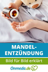 Bildergalerie Mandelentzundung Mandelentzundung Mandelentzundung Kinder Kinderkrankheiten