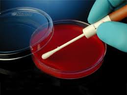 Double zone hemolysis produced by clostridium perfringens. Hardy Diagnostics 0318k Mckesson Medical Surgical