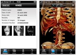 We did not find results for: Open View And Read Dicom Dcm Medical Images In Mac Os X Ios With Osirix Osxdaily