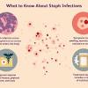 A staph infection can cause red pimples or a rash, though it may also look like sores or blisters. 3