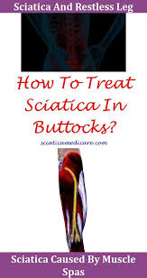 Pin On Sciatica