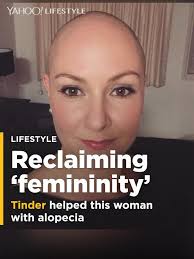 How Tinder helped this woman with alopecia reclaim her 'femininity'