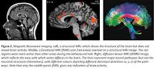 Image result for what is used to document the time-course of neural events