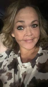 Non scale victory after bariatric surgery