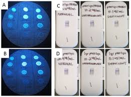 Image result for G6PD Deficiency Detection