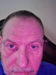 Nothing beats a good morning slinger in the eye at 0400 . I love this dog