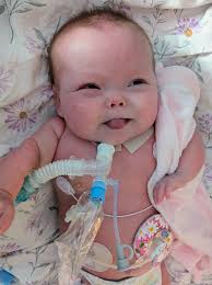 Amaya's Medical Treatment Update