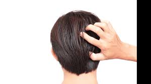 It's a genetic condition found in both men and women. 5 Early Signs You Re Going Bald Fight Hair Loss Immediately