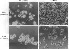Reconstituted basement membrane (matrigel) and laminin can enhance the  tumorigenicity and the drug resistance of small cell lung