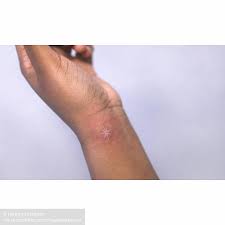 White Ink Star Tattoo On Dark Skin White Ink Tattoos Healed White Tattoo Star Tattoos