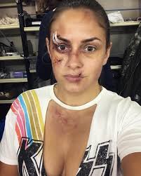 😱😱😱 ⬇️ ⬇️ ⬇️ ⬇️ ⬇️ ⬇️ ⬇️ ⬇️ Spokojnie, to nie są pozostałości po  ostatnim sparingu 😉 to charakteryzacja z planu serialu „Znaki”, który  naprawdę będzie super produkcją, a ja mam