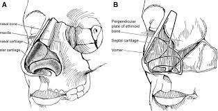 You might only have one fracture, or you might have several broken bones. Diagnosis And Management Of Nasal Fractures Operative Techniques In Otolaryngology Head And Neck Surgery