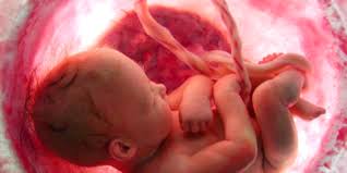 Obat batuk untuk bayi 6 bulan yang aman dan paling recomended. 5 Komplikasi Utama Ketika Pranatal Pada Bayi Baru Lahir Yang Perlu Anda Awasi