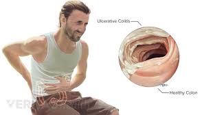 Learn about causes of upper and middle back pain. Pin On Kidney Infection