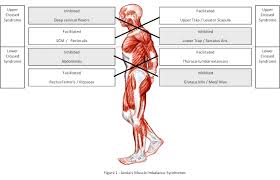 They are divided into three groups, as shown below. Do Planks Tighten Up Hip Flexors Back Pain When Doing Core Exercises Physical Fitness Stack Exchange
