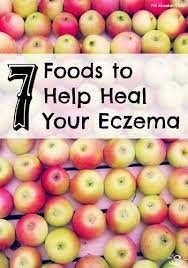 7 Foods To Help Heal Eczema From The Inside Out Health Natural Health Care Eczema Diet