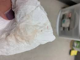 Jun 24, 2021 · the end — and a whole new beginning! Light Pink Discharge 7 Weeks Pregnant