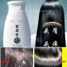 You just have to prepare a paste with baking soda, a little water, and lemon. Dandruff Relieve Itching Shampoo Mite Removal Loss Hair Products Remove Dandruff Control Oil Male Female Hair Care Repair Health Shampoos Aliexpress