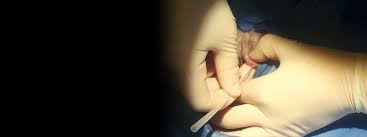 Urethral Obstruction In Male Cats Today S Veterinary Nurse