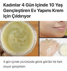 Kadinlar 4 Gun Icinde 10 Yas Genclestiren Ev Yapimi Krem Icin Cildiriyor Bitkilog Face Mask Diy Acne Acne Scar Removal Face Mapping Acne