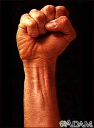 38 years experience family medicine. Carpal Tunnel Syndrome Medlineplus Medical Encyclopedia