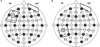 size and montage parameters of tdcs stimulation tdcs was