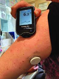 The freestyle librelink app is only compatible with certain mobile devices and operating systems. The Freestyle Libre Flash Glucose Monitoring System Worn By The Nurses Download Scientific Diagram