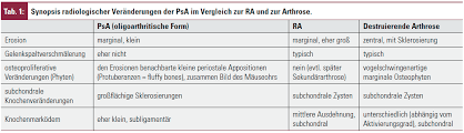 Radiologische Diagnostik Der Psa Wo Ist Die Grenze Zur Rheumatoiden Arthritis Und Zur Arthrose Medmedia