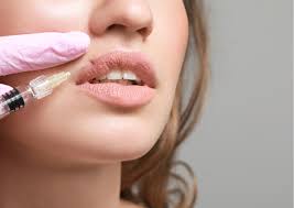 Lip Fillers, Filler Migration, Dissolving, Bumps... - Youtube