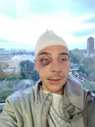 Prayer request for brother with brain injury