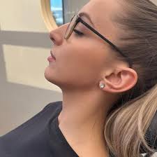 Redefining the gonial angle 📐 This is a very simple and feminine approach  to adding definition and length to the jawline This is part one of her jaw  filler journey! Next we