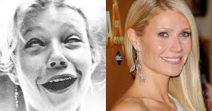 Gwyneth Paltrow Celebrities With Braces Gwyneth Paltrow Brace Face
