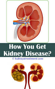 Signs Of Kidney Infection Kidney Disease Symptoms Kidney Disease Chronic Kidney Disease