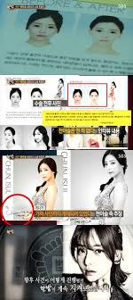 각자 고정픽도 있고 싫은 멤버들도 있고. í•œë°¤ Aì„±í˜•ì™¸ê³¼ ì²œì´ìŠ¬ ì„±í˜•ì „í›„ ì‚¬ì§„ìœ¼ë¡œ í™ë³´ ë„¤ì´íŠ¸ ì—°ì˜ˆ