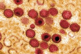 It can appear in a variety of forms ranging from peracute, acute, subacute. African Swine Fever Virus The Pirbright Institute