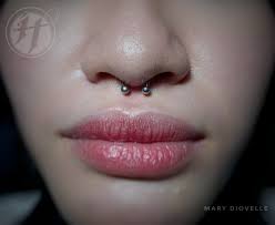 SEPTUM Thank you. For appointments and inquiry you may send us a message