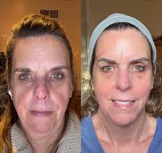 Morning Portia Can I get the marula routine for 1st week 2nd week and 3rd  week Thanks in advance