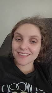 I cannot even believe this is my face! After having a hysterectomy and  being