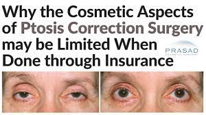 It's worth noting that plastic or cosmetic surgical procedures not on the government's medicare benefits schedule (mbs) list are unlikely to be covered by private health insurance. Why Eyelid Ptosis Surgery Covered By Insurance Does Not Include Cosmetic Eyelid Surgery Youtube