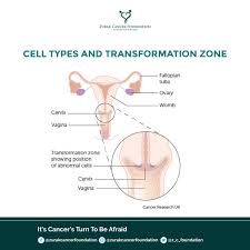 Cervical cancer awareness month is observed every january. Zurak Cancer Foundation On Twitter Cervical Cancer Awareness Month