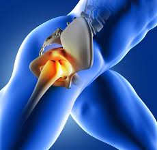 Cancerous cells can weaken the bone, and this may sometimes result in a fracture. Hip Pain