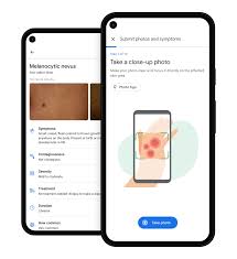 Enjoy various free skins today with your account! Google Announces Health Tool To Identify Skin Conditions The Verge