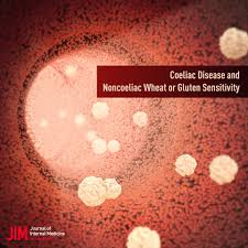Some people develop celiac disease as a child, others as an adult. Coeliac Disease And Noncoeliac Wheat Or Gluten Sensitivity Rej 2020 Journal Of Internal Medicine Wiley Online Library